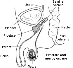 Prostate